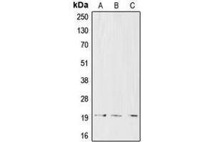 Western blot analysis of CD3d expression in CCRFCEM (A), Jurkat (B), HuT78 (C) whole cell lysates.