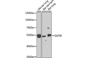 Western blot analysis of extracts of various cell lines, using GLP1R antibody (ABIN6131006, ABIN6141138, ABIN6141140 and ABIN6224643) at 1:1000 dilution.
