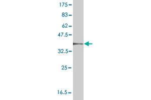 Cathepsin K antibody  (AA 220-329)