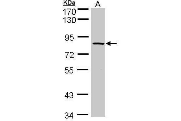 ADAM33 Antikörper  (C-Term)