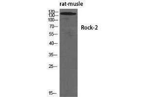 Western Blotting (WB) image for anti-rho-Associated, Coiled-Coil Containing Protein Kinase 2 (ROCK2) (Tyr466) antibody (ABIN3186830) (ROCK2 antibody  (Tyr466))