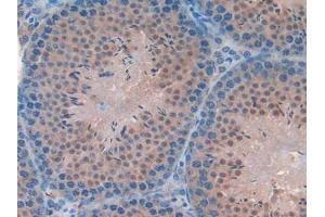 IHC-P analysis of Mouse Testis Tissue, with DAB staining. (FAM19A2 antibody  (AA 31-119))