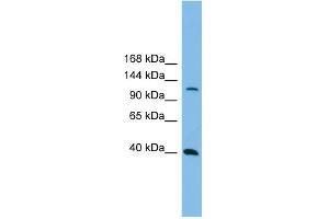 Host:  Rabbit  Target Name:  MAP3K14  Sample Tissue:  Human THP-1 Whole Cell  Antibody Dilution:  1ug/ml (MAP3K14 antibody  (N-Term))
