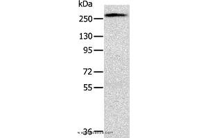 Western blot analysis of Huvec cell, using TLN1 Polyclonal Antibody at dilution of 1:200 (TLN1 antibody)