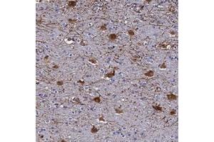 Immunohistochemical staining of human cerebral cortex with SYT13 polyclonal antibody  shows strong cytoplasmic positivity in neuronal cells at 1:50-1:200 dilution.