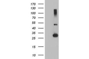 Western Blotting (WB) image for anti-Regulatory Factor X-Associated Ankyrin Containing Protein (RFXANK) antibody (ABIN1500680) (RFXANK antibody)