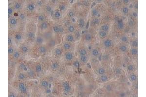 Detection of LEI in Rat Liver Tissue using Polyclonal Antibody to Leukocyte Elastase Inhibitor (LEI) (SERPINB1 antibody  (AA 17-332))