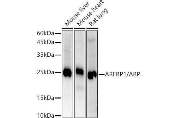 ARFRP1 anticorps