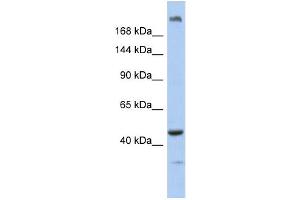 WB Suggested Anti-KIAA0284 Antibody Titration: 0.