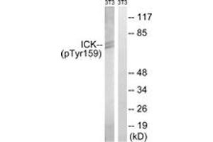 Western blot analysis of extracts from NIH-3T3 cells treated with starved 24h, using ICK (Phospho-Tyr159) Antibody. (ICK antibody  (pTyr159))