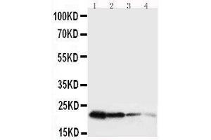 Anti-mouse Growth Hormone antibody, Western blotting Lane 1: Recombinant Mouse GH Protein 10ng Lane 2: Recombinant Mouse GH Protein 5ng Lane 3: Recombinant Mouse GH Protein 2 (Growth Hormone 1 antibody  (AA 27-216))