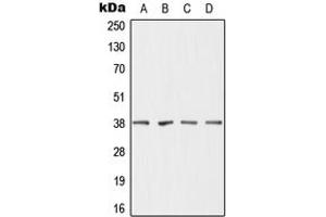 Western blot analysis of DHRS7 expression in MCF7 (A), HepG2 (B), mouse liver (C), rat liver (D) whole cell lysates. (DHRS7 antibody  (C-Term))