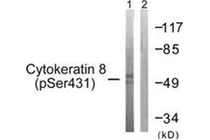 Western blot analysis of extracts from 293 cells treated with EGF 200ng/ml 30', using Keratin 8 (Phospho-Ser432) Antibody. (KRT8 antibody  (pSer432))