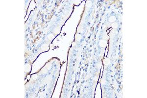Immunohistochemistry of paraffin-embedded mouse intestin using CD13/ANPEP Rabbit pAb (ABIN6131185, ABIN6136911, ABIN6136912 and ABIN6221309) at dilution of 1:50 (40x lens). (CD13 antibody  (AA 668-967))
