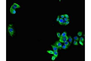 Immunofluorescent analysis of PC-3 cells using ABIN7158996 at dilution of 1:100 and Alexa Fluor 488-congugated AffiniPure Goat Anti-Rabbit IgG(H+L) (MARK3 antibody  (AA 368-667))