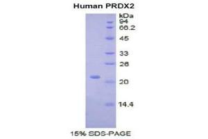 SDS-PAGE (SDS) image for Peroxiredoxin 2 (PRDX2) (AA 6-164) protein (His tag) (ABIN1877329) (Peroxiredoxin 2 Protein (PRDX2) (AA 6-164) (His tag))