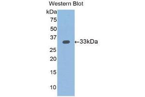 Western Blotting (WB) image for anti-Slit Homolog 1 (SLIT1) (AA 345-623) antibody (ABIN1176116) (SLIT1 antibody  (AA 345-623))