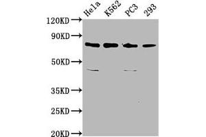 Western Blot Positive WB detected in: Hela whole cell lysate, K562 whole cell lysate, PC-3 whole cell lysate, 293 whole cell lysate All lanes: INTS13 antibody at 3.