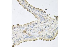 Immunohistochemistry of paraffin-embedded human prostate using AKT1 antibody (ABIN1876708) at dilution of 1:100 (40x lens). (AKT1 antibody)
