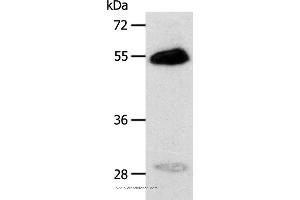 Western blot analysis of Human liver cancer tissue, using CA14 Polyclonal Antibody at dilution of 1:400 (CA14 antibody)