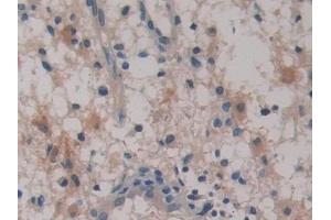 Immunohistochemistry (IHC) image for anti-serpin Peptidase Inhibitor, Clade B (Ovalbumin), Member 6 (SERPINB6) (AA 1-376) antibody (ABIN7441031)