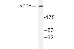 Image no. 1 for anti-Acetyl-CoA Carboxylase alpha (ACACA) antibody (ABIN271866) (Acetyl-CoA Carboxylase alpha antibody)