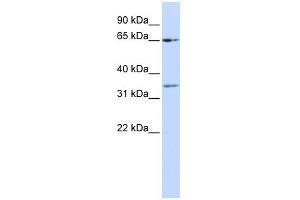 WB Suggested Anti-ZNF157 Antibody Titration:  0.