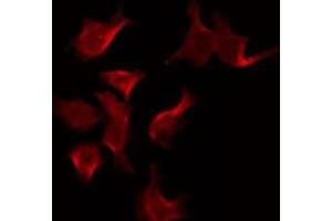 HTR5B anticorps