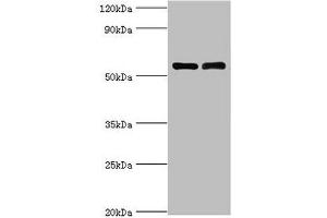 Western blot All lanes: IL7R antibody at 4 μg/mL Lane 1: K562 whole cell lysate Lane 2: Jurkat whole cell lysate Secondary Goat polyclonal to rabbit IgG at 1/10000 dilution Predicted band size: 52, 35, 30, 29 kDa Observed band size: 52 kDa (IL7R antibody  (AA 21-239))