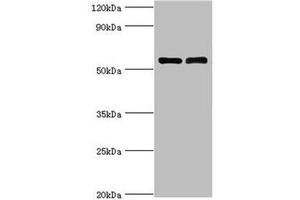 IL7R 抗体  (AA 21-239)
