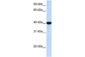 G6PC antibody used at 1 ug/ml to detect target protein. (G6PC antibody  (N-Term))
