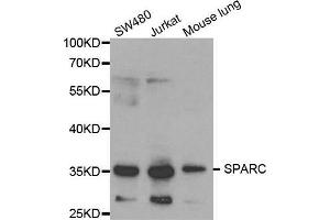 Western blot analysis of extracts of various cell lines, using SPARC antibody. (SPARC antibody  (AA 18-303))