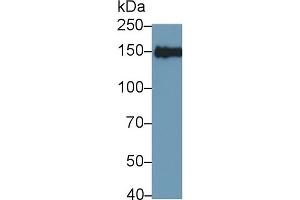 Detection of IRS2 in MCF7 cell lysate using Polyclonal Antibody to Insulin Receptor Substrate 2 (IRS2) (IRS2 antibody)