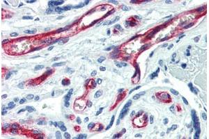 Human Placenta (formalin-fixed, paraffin-embedded) stained with CD34 antibody ABIN461990 at 1:50 followed by biotinylated anti-mouse IgG secondary antibody ABIN481714, alkaline phosphatase-streptavidin and chromogen. (CD34 antibody  (FITC))