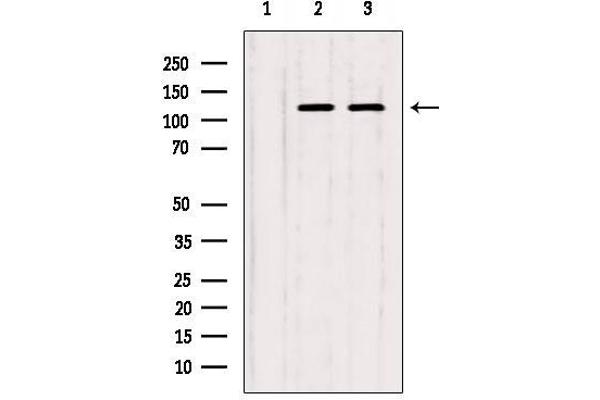 ITPKB antibody  (Internal Region)