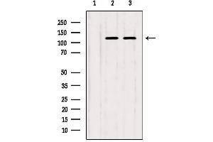 Western blot analysis of extracts from various samples, using IP3KB Antibody. (ITPKB antibody  (Internal Region))