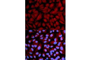 Immunofluorescence analysis of U2OS cell using CASK antibody. (CASK antibody  (AA 1-300))
