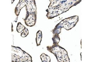 IHC analysis of DLL1 using anti-DLL1 antibody (ABIN7600324).