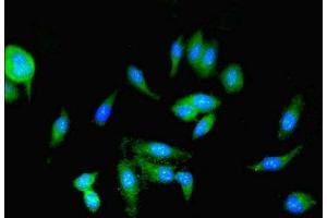 Immunofluorescent analysis of Hela cells using ABIN7166912 at dilution of 1:100 and Alexa Fluor 488-congugated AffiniPure Goat Anti-Rabbit IgG(H+L) (PKM antibody  (AA 2-192))