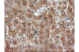 Immunohistochemical staining of paraffin-embedded Human liver tissue using anti-HDHD2 mouse monoclonal antibody. (HDHD2 antibody)