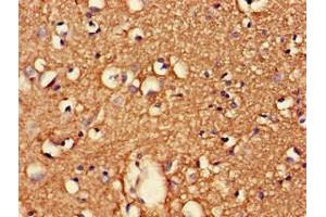Immunohistochemistry of paraffin-embedded human brain tissue using ABIN7147230 at dilution of 1:100 (CDK5RAP2 antibody  (Regulatory Subunit))