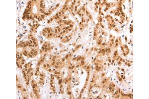 Immunohistochemistry (IHC) image for anti-Tax1 (Human T-Cell Leukemia Virus Type I) Binding Protein 1 (TAX1BP1) antibody (ABIN2422292) (TAX1BP1 antibody)
