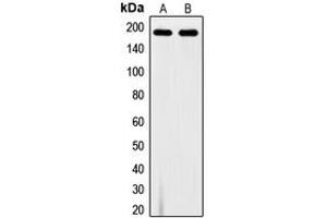 Western blot analysis of VEGFR1 (pY1213) expression in A10 (A), MDAMB231 (B) whole cell lysates. (FLT1 antibody  (C-Term, pTyr1213))