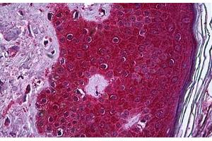 Immunohistochemistry (Formalin-fixed Paraffin-embedded Sections) (IHC (fp)) image for anti-Tumor Necrosis Factor alpha (TNF alpha) (AA 1-234) antibody (ABIN790510)