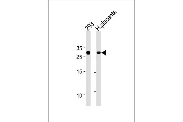 TCF21 antibody  (C-Term)