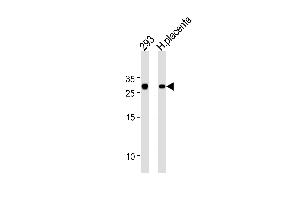 TCF21 Antibody (C-term) (ABIN655524 and ABIN2845037) western blot analysis in 293 cell line and human placenta tissue lysates (35 μg/lane).
