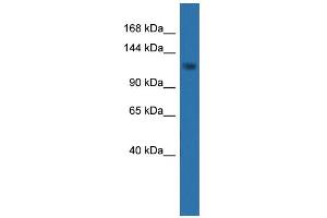 WB Suggested Anti-CDKL5 Antibody Titration: 0. (CDKL5 antibody  (C-Term))