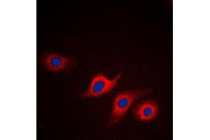 Immunofluorescent analysis of Apolipoprotein L2 staining in HepG2 cells. (Apolipoprotein L 2 antibody  (Center))