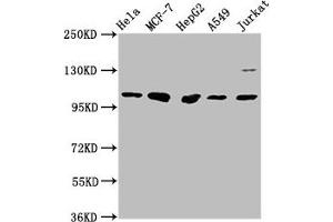 Western Blot Positive WB detected in: Hela whole cell lysate, MCF-7 whole cell lysate, HepG2 whole cell lysate, A549 whole cell lysate, Jurkat whole cell lysate All lanes: GANC antibody at 1:1000 Secondary Goat polyclonal to rabbit IgG at 1/50000 dilution Predicted band size: 105 kDa Observed band size: 105 kDa (GANC antibody  (AA 171-318))