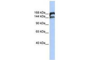 Image no. 1 for anti-Topoisomerase (DNA) II beta 180kDa (TOP2B) (AA 1548-1597) antibody (ABIN6742741) (TOP2B antibody  (AA 1548-1597))